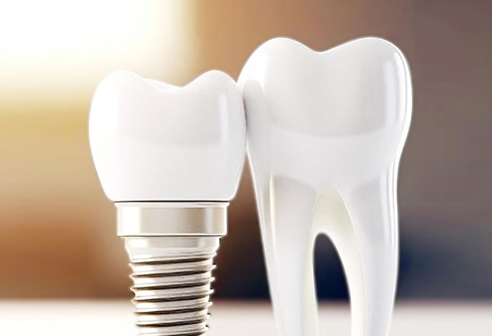 Implant dentar krahasuar me dhëmb natyral